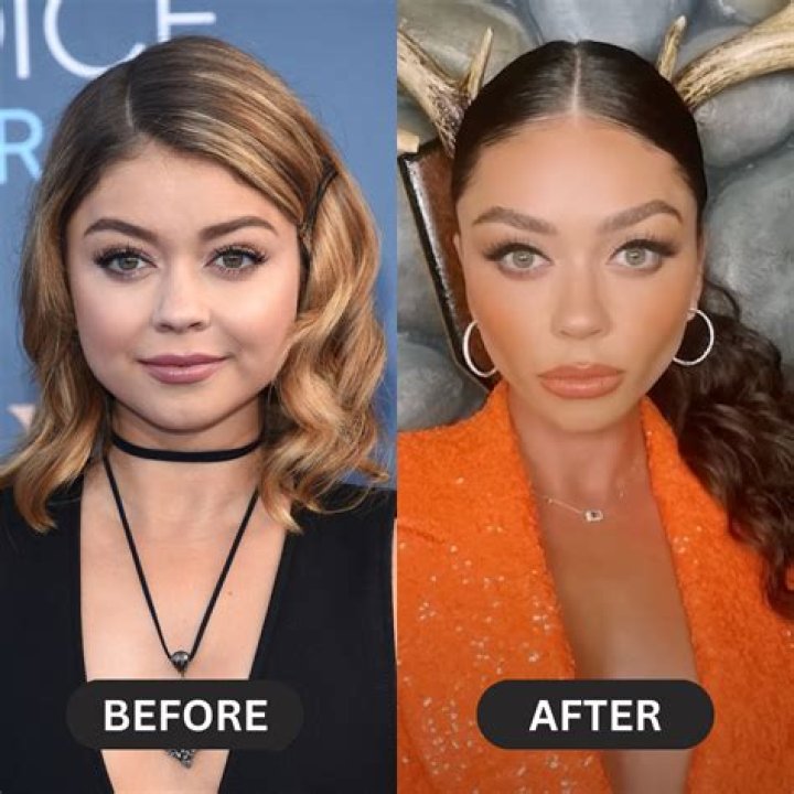 17 Celebs Who Have Had A Cosmetic Surgery Wonder Wardrobes