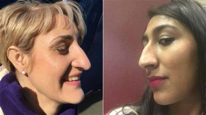 50 Celebrities With Big Noses Actresses, Actors or Singers Hood MWR