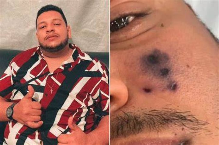 Brazilian Singer Darlyn Morais Dies After Being Bitten By A Spider