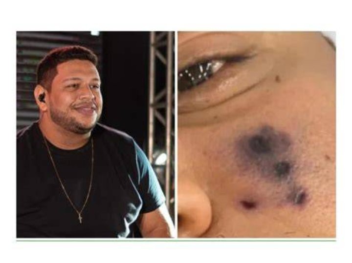 Darlyn Morais Spider bites, kills popular Brazilian singer