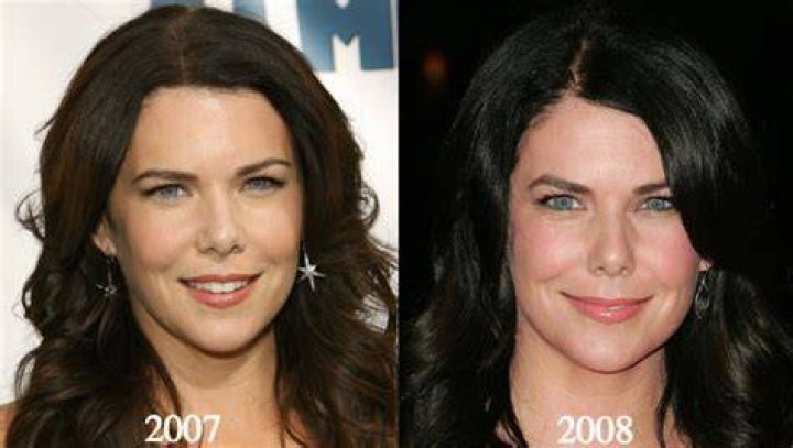 Did Lauren Graham Get Plastic Surgery Such As Nose Job?
