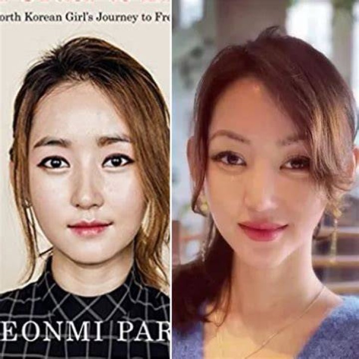 Did Yeonmi Park Had A Plastic Surgery? Is She Fake? Husband, Son And Instagram |