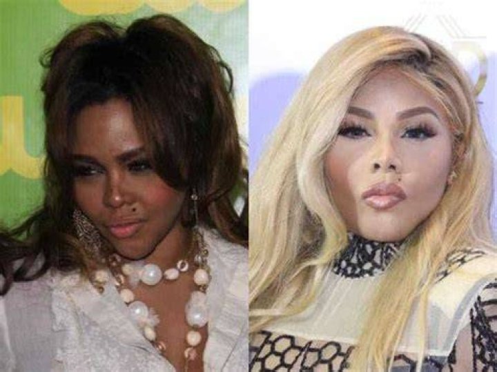 Discover The Shocking Truth Behind Celebrity Skin Bleaching