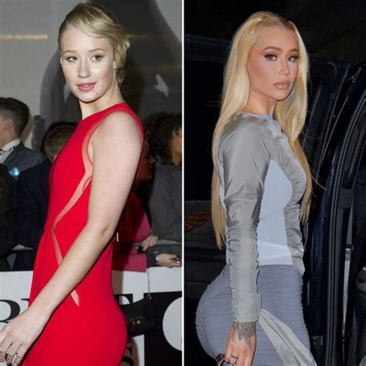 Exploring Body Image And Empowerment Through "iggy Azalea Tits"