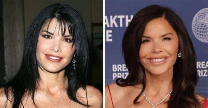 Has Lauren Sanchez Had Plastic Surgery? The Truth Revealed