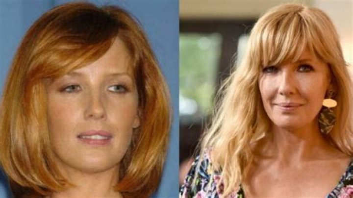 Kelly Reilly&rsquo;s Plastic Surgery The Yellowstone Cast Has Been Accused