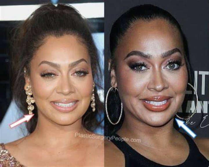 La La Anthony Plastic Surgery and Body Measurements Plastic Surgery Feed