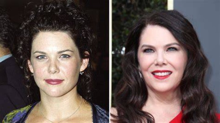 Lauren Graham's Plastic Surgery Journey Explored