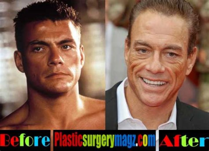 Male plastic surgery gone awry