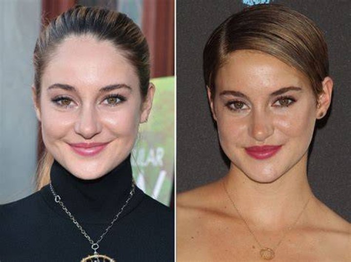 Shailene Woodley's Nose Job Journey: Before And After Transformation