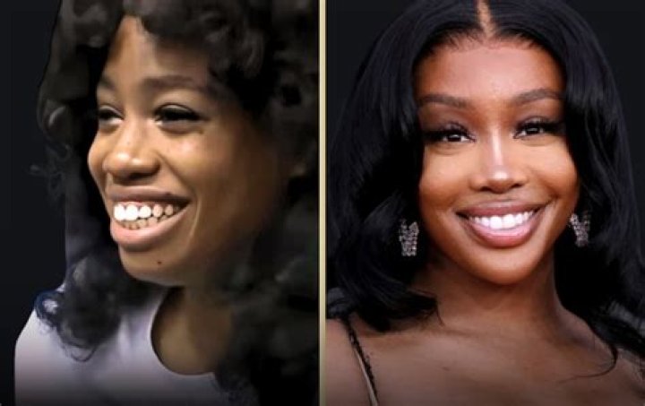 SZA's Plastic Surgery Journey And Its Impact