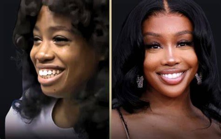 SZA Confirms the Plastic Surgery Procedure She&rsquo;s Had Done, Explains Why