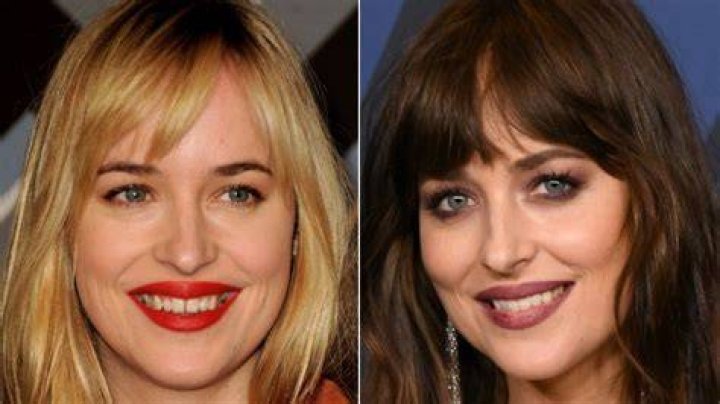 The Best Celeb Tooth Transformations