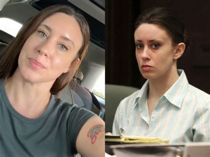 The Ultimate Guide To Casey Anthony's Plastic Surgery Journey