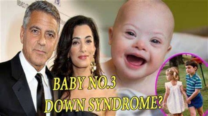 Unraveling The Truth About Down Syndrome