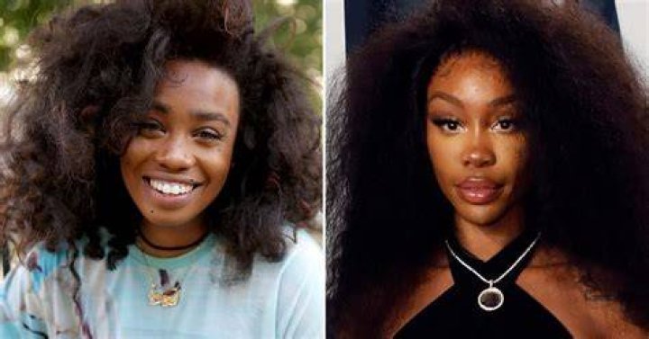 Unveiling The Untold Truths: SZA Before Surgery