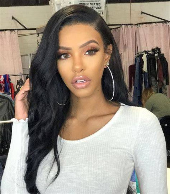 Yodit Yemane, A Beautiful Model, Her Struggle, Surgery & Transformation